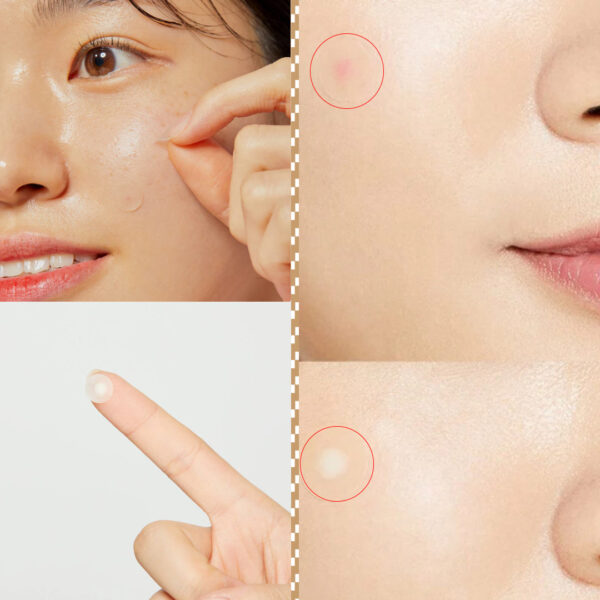 Cosrx Acne Pimple Master Patch: Your Solution to Spot Treatment 24 Patches - Image 5