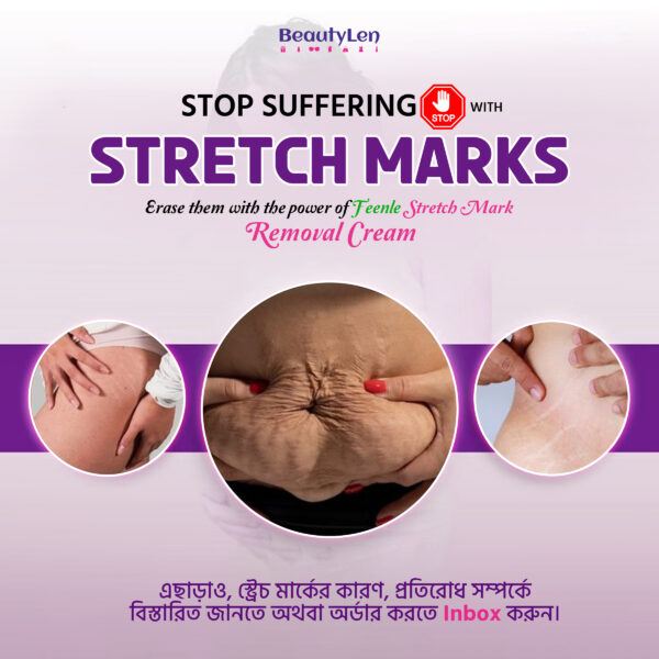 Feenle Natural Stretch Mark Removal Cream 100gm - Image 2