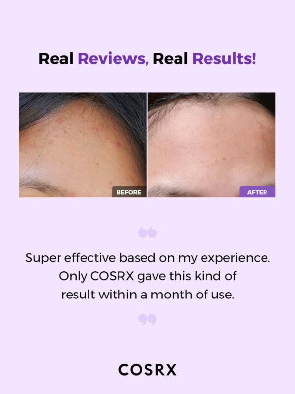 Cosrx AHA/BHA Clarifying Treatment Toner 150ml - Image 4