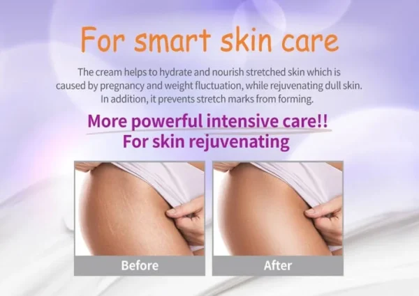 Pax Moly Mom’s Care Stretch Mark Cream 70gm - Image 9